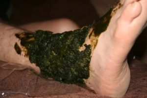 Comfrey poultice